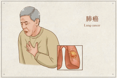 国际肺癌日，一起抵制肺癌！